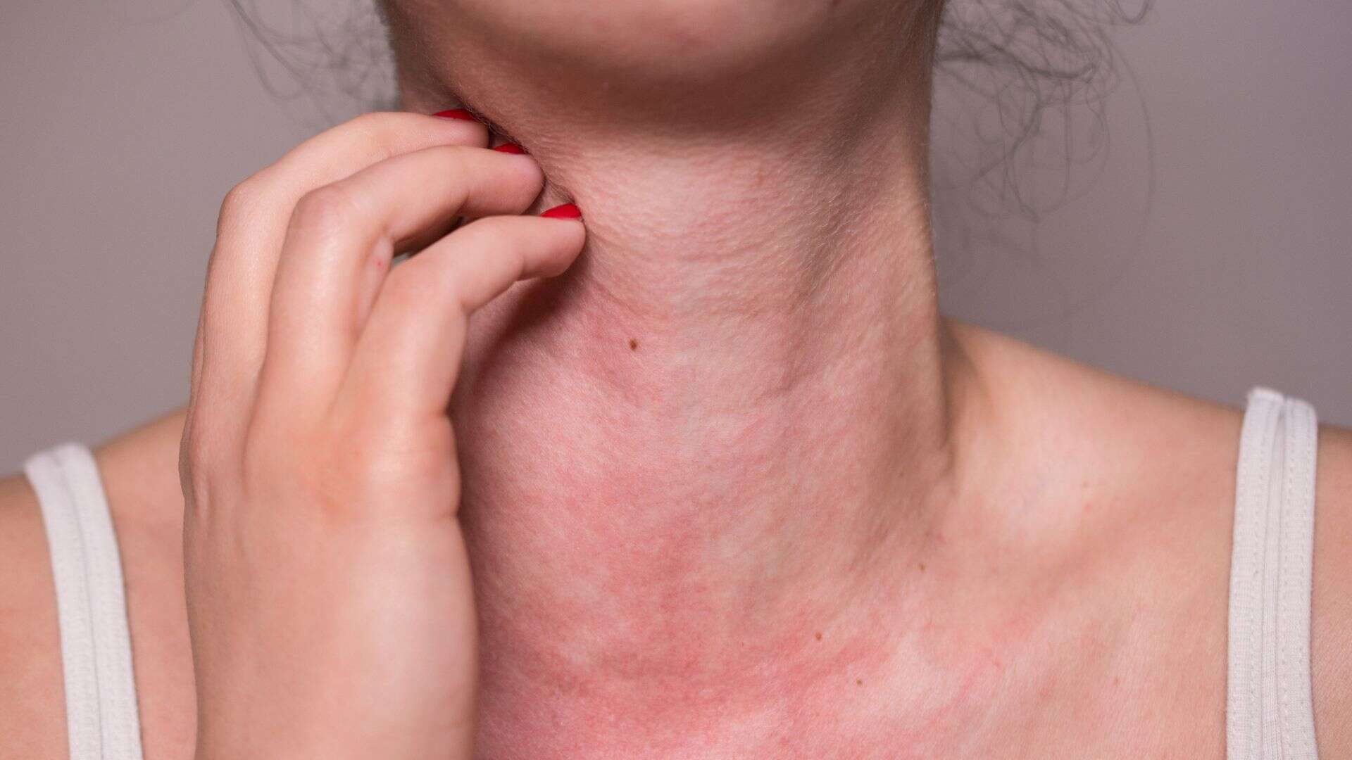 woman itching her neckl